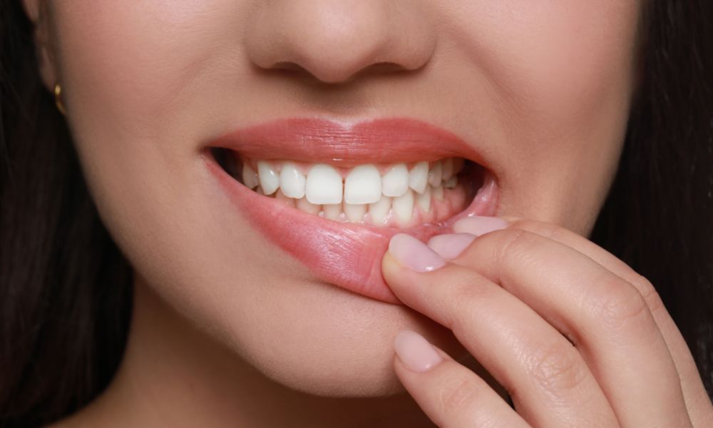 Treatment for Receding Gums